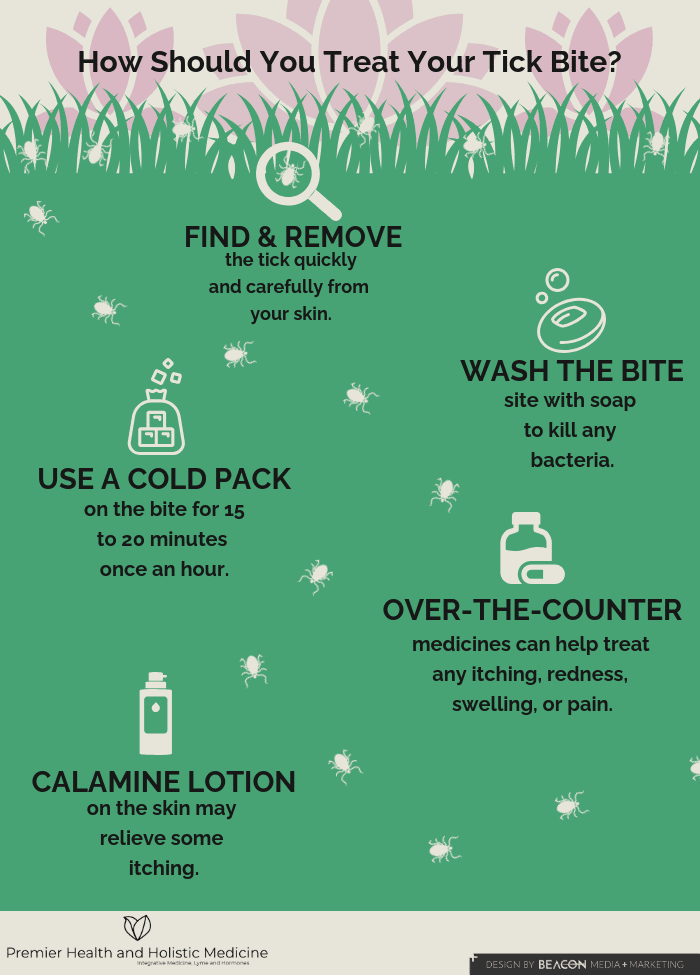 How Should You Treat Tick Bites?  infographic